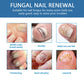 Nail Fungus Treatment Solution