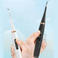 🦷🔥Bargain Alert ￡14.99!!⚡Electric Ultrasonic Dental Scaler | Remove Tartar & Plaque✨