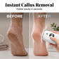 🔥Hot Sale 50% OFF🔥 Compact Automatic Foot Pedicure Grinder – Rechargeable, 360° Roller, for Callus & Dead Skin 🦶