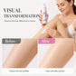 🔥Hot Sale 50% OFF🔥 Gentle Hair Removal Mousse – Helps Remove Unwanted Body Hair,  for Sensitive Skin 🧴