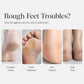 🔥Hot Sale 50% OFF🔥 Exfoliating Hydrating Foot Peel Mask – Helps Reveal Softer-Looking Feet, Single-Use Foot Mask Socks, for Dry & Callused Feet 🦶