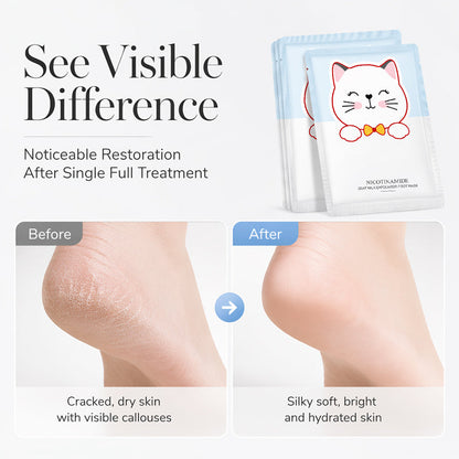 🔥Hot Sale 50% OFF🔥 Exfoliating Hydrating Foot Peel Mask – Helps Reveal Softer-Looking Feet, Single-Use Foot Mask Socks, for Dry & Callused Feet 🦶